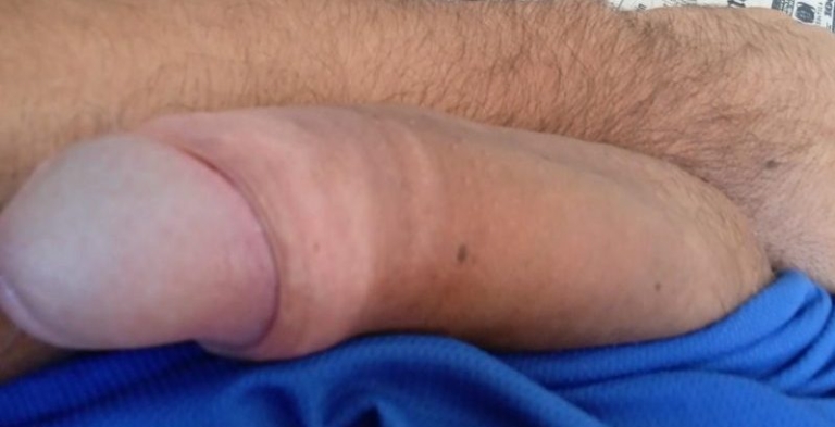 Foto de Parrudo Dotado